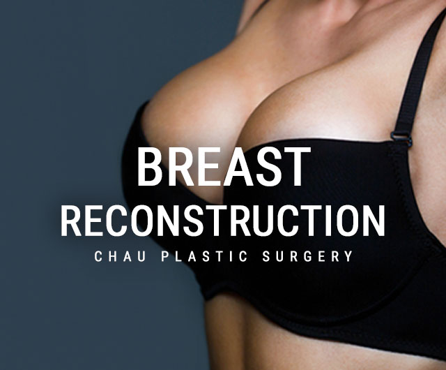 Breast Reconstruction